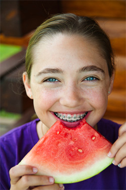 Foods Easy To Eat With Dental Braces