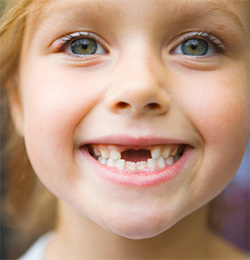 How To Pull Loose Teeth