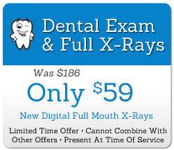 Full Dentist Exam And X-rays For Only Fifty Nine Dollars