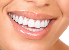Professional Dental Whitening Service In Warren MI