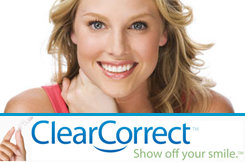 Invisible Braces Like Invisalign And Clear Correct