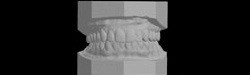 Plaster Teeth